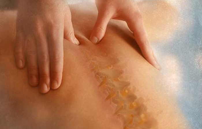 FISIOTERAPIA